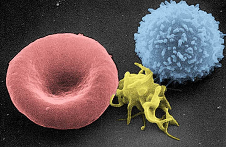 A platelet together with red and white blood cells